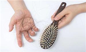 年輕人脫發(fā)的4個(gè)主要原因，防脫生發(fā)洗發(fā)水哪個(gè)牌子好 防脫生發(fā)洗發(fā)水推薦