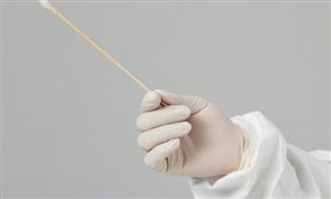 深圳新增36例病例 核酸檢測市場需求分析 核酸檢測究竟有多暴利?