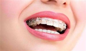 口腔正畸現狀及發(fā)展趨勢分析 正畸人才缺乏限制行業(yè)發(fā)展