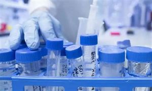 生物試劑細(xì)分市場占比 2022生物分子試劑行業(yè)發(fā)展前景及規(guī)模分析