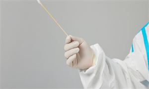 基因檢測市場調(diào)研 第三方醫(yī)學(xué)檢驗(yàn)所市場空間較大