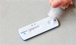 抗原試劑一盒難求局面或將扭轉 抗原試劑行業(yè)現(xiàn)狀及前景分析