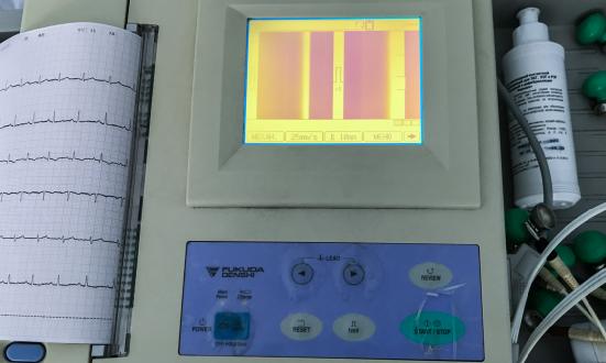 2023心電監(jiān)護(hù)儀行業(yè)報(bào)告 心電監(jiān)護(hù)儀行業(yè)市場(chǎng)現(xiàn)狀調(diào)研及發(fā)展前景研究