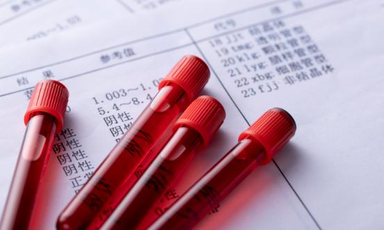 2024中國血液檢測行業(yè)供需形勢分析 血液檢測行業(yè)未來發(fā)展趨勢預(yù)測