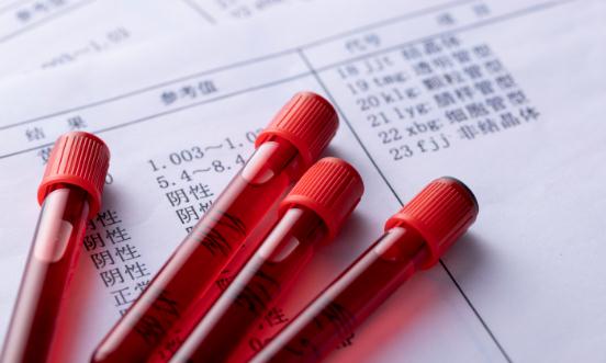 血液制品產(chǎn)業(yè)前景展望 未來行業(yè)的集中度會(huì)進(jìn)一步提高